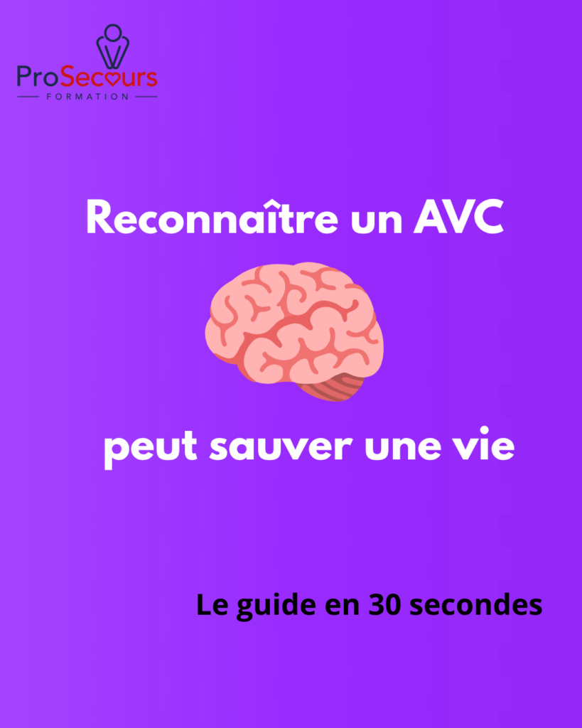 Comment reconnaître un AVC et réagir rapidement ? img 7619